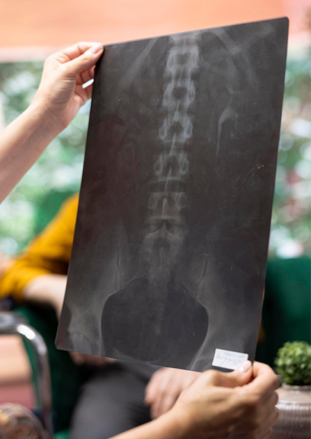 Bel – Boyun Kaymaları